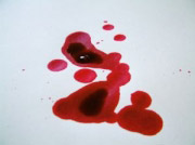 Krv anemija