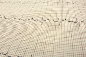 Veza između stresa i metaboličkog sindroma